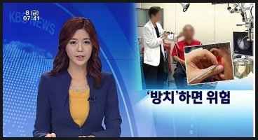 벨톤보청기-노인 난청 방치하면 치매 위험 ↑