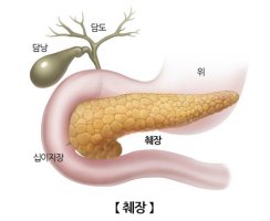 췌장을 살리는 기술