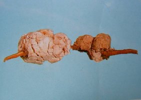 복령(茯笭)-소나무 뿌리 기생 균핵