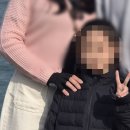 [공지] [대전 화상병원] 심재성 2도 화상 치료 후기｜기간·통증·비용 정리