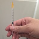 숨케어한의원 | 고든한의원 수원탈모병원 원형탈모 PDRN주사 10회차 후기 !