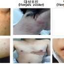 감염병 | 엠폭스 관련 자주하는 질문 FAQ <<b>중앙</b><b>방역</b><b>대책</b><b>본부</b>>