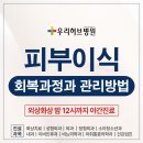 엠허브메디컬센터 맞은편 | 달서구화상병원, 화상 후 피부 이식 수술! 회복 과정과 관리 방법