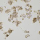 새우의 섬모충 Vorticella (종벌레) 이미지