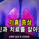 기흉증상 원인과 치료 살펴볼 필요가 있어요 이미지