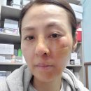 전혜진 카카오 검색결과