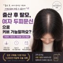 두피를 디자인하는 여자 | 출산 후 탈모, 여자 두피문신으로 커버 가능할까요?