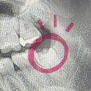 김승룡건치과의원 | 왕쫄보의 매복사랑니 발치 3일차 후기 세상모든사랑니치과 (비용, 통증, 붓기)