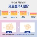 비엘에스의원 네이버블로그