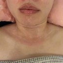 북아현동 주민센터 | 신촌 피부관리 웨딩관리 | 라르본뷰티 브이라인 리프팅 후기