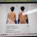 운양동피부관리 윤슬아 토탈뷰티, 인비덤맥스 복부리셋 후기