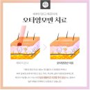 청담고운선의원 네이버블로그