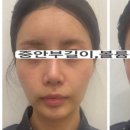 에스테틱고우다