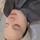 400 | 동탄 슈링크 피부과 추천, 400삿 솔직 후기