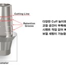 STL치과기공소 네이버블로그