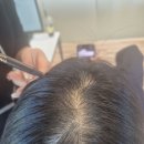 대구제이케이(JK)병원 | 대구두피문신으로 고민중이시라면 고민없이 Jk 두피관리센터