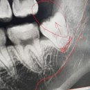 강승우치과의원 이미지