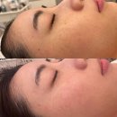 전주보석허브사우나평화점 | 피부관리 리유에스테틱 전북 전주시 완산구 평화동2가 가격위치주소이벤트할인 총정리