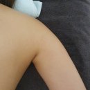 울산 울주군 문수산푸르지오 상가 오즈에스테틱 팔뚝관리 솔직후기