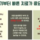 보명레이져