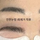 멍클린 이미지