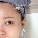 누예 | [청주 개신동 피부관리] 내 피부에 맞춤관리, 누예뷰티에서 숨은 고수 원장님께 맞춤관리✨