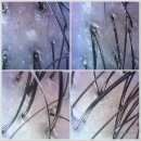 닥터포헤어 케어랩 강남 | 닥터포헤어 케어랩 강남본점 지성두피케어 내돈내산 해봄 찐후기임