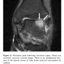 발목과 발의 x-ray, ct, mri 초음파 이미지 - 대박자료 이미지