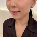 [강남 피부관리] 미더베스트 대치 본점 만족스러웠던 ‘셀럽관리’ 후기