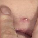 고주파, 캐비테이션 3mac lipo, 맥슈어, 아크소닉 이미지
