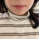 평안어린이집 | 잠실역피부과 잠실슈링크 일주일 지난 30대 후반 리얼 후기