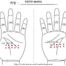 수지침 요법 임신에서 출산까지의 건강관리 이미지