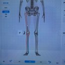 중앙뷰티 | 목, 어깨 비대칭 체형관리 전/후 사진 공개, 신림역 관리샵 <스페이스 뷰티 신림중앙점> 후기