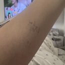 건지로 | 인천 서구) 그린산부인과 제왕절개 40주 출산 4박5일 솔직 후기