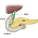 바터 팽대부 암[AOV cancer] 소화기질환, 종양혈액질환 이미지