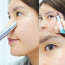 피디테크 | 아이밴딩 피디알엔샷 뷰티디바이스로 눈가 처짐 관리해 보니