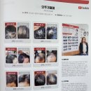 와이엘솔루션 | 탈모고객이 사라지는 헤어샵~ G헤어샵에서 탈모고민 해법을 상담받으세요