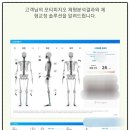 엠지테라피