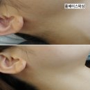 피우다, 헤어 | 마산 페이스왁싱 효과 있을까? 헤어라인·인중·얼굴잔털 정리 후기 ✨👍🏻