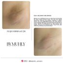 복숭아뼈미백 이런 후기 보신 적 있을까요?