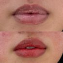 도아합주실 | 구서동 륀느뷰티 입술 반영구, 입술 반영구 리얼후기, 검은 테두리 콤플렉스에서 벗어나 자신감 찾은 변화