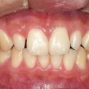 나라치과기공소 이미지