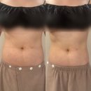 마이크로웨이브 관리 티리온X 후기 순환관리와 바디케어 동시에