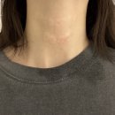 센텀메디컬 | 부산 센텀 메디컬오 모공리액터 8회차 후기 (+목 부위 탄력관리, 실장님 상담)
