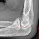 이석휴정형외과의원 이미지