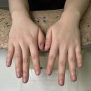 물어뜯는손톱교정, 진짜 되네? 미미네일 아크릴 교정 네일 후기