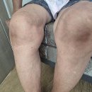 세종복지용구 이미지