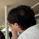 만나한의원 | 10달간의 남성 스트레스성 원형 탈모 극복기🥹 한의원 면역치료, 스테로이드 주사 후기