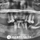 바른이웃치과의원 이미지