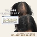 서울 송파 여자두피문신 후기, 가르마와 정수리 고민 해결
